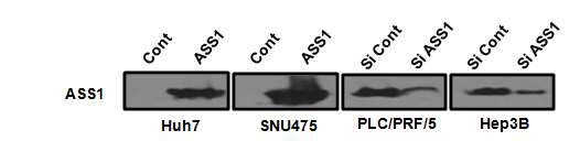 ASS1 발현이 다른 간암 세포주에서 ASS1 발현 조절