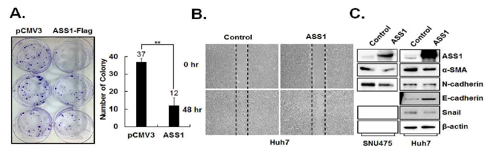 ASS1 발현에 따른 간암세포의 증식 및 전이억제 (A) Colony forming assay, (B) Migration assay(wound healing assay), (C) altered signaling