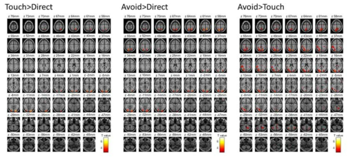 Touch, Avoid 조건에서의 신경활동 및 Avoid와 Touch 조건의 대조 결과 (slice image)