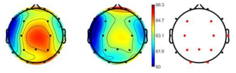 알파 밴드 (8-12Hz) 분석결과 (좌측: 지각운동, 가운데: 동작보고, 우측: 통계결과)