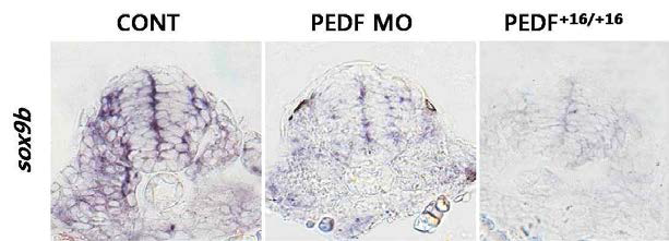 PEDF loss-of-function배아에서 Whole-mount in situ hybridization에 의한 sox9b유전자의 발현패턴 비교