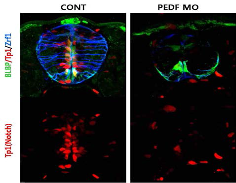 PEDF loss-of-function에 따른 notch responsive cell의 변화