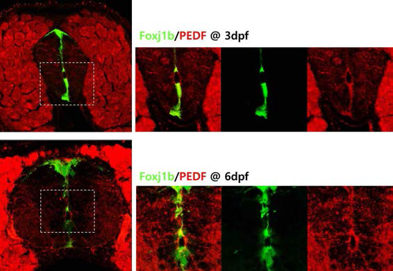 PEDF protein expression in ependymal cell during development