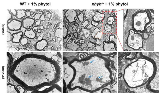 전자현미경(TEM) 분석을 통한 phytol 축적에 따른 수초화 및 액손 관찰