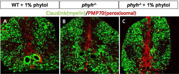 phytol을 섭취한 WT군(A)과 정상식이를 섭취한 phyh knock out(B)과 비교하여 phytol을 섭취한 phyh knockout(C)에서 peroxisomal proliferation 증가(red signal)