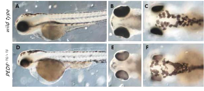 PEDF knock-out 제브라피쉬의 표현형