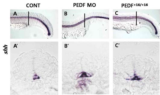 PEDF loss-of-function배아에서 Whole-mount in situ hybridization에 의한 shh 유전자의 발현패턴 비교