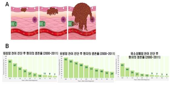 암의 성장 및 전이를 나타낸 그림(A)과 2000~2011 사이 미국 암환자에서 전이 진단후 생존율을 나타낸 그래프 (B)