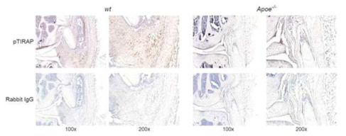 관절염이 유도된 wild type 생쥐와 ApoE 결손 생쥐의 관절조직을 면역조직화학검사 (immunohistochemistry) 기법을 활용하여 anti-phospho TIRAP antibody나 control Rabbit IgG로 염색하였음