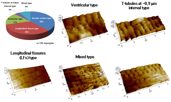 Rat 심방근 세포 막 표면 구조를 SICM 영상에 따라 분류함. 심방근 세포막 표면구조를 T-tubule 구멍이 존재하지 않는 smooth type, T-tubule 구멍이 뚜렷이 관찰되는 ventricular type, 두 가지 구조가 섞여있는 mixed type으로 세분하고 각 그룹의 분율을 측정함