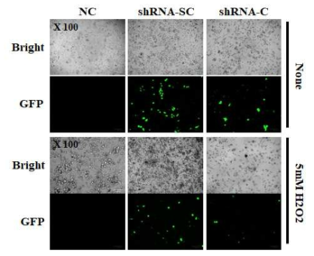 BCSC에서의 CD66c의 shRNA의 knockdown 및 5mM H2O2 3시간 노출 후 하루 배양한 결과 (A: RT-PCR, B: 형광현미경 관찰)