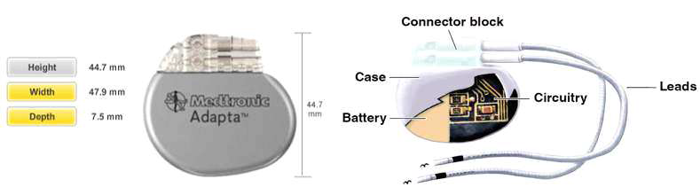Medtronic社의 심장박동기 및 내부 구성