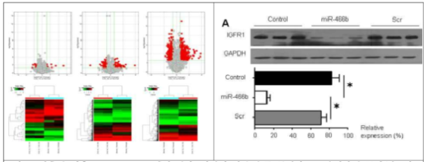 뇌출혈 이후 circular RNA 발현 변화: 시간이 지날 수록 통계적으로 유의하게 증가/감소하는 circular RNA가 증가하고 (좌), 이 때 감소하는 circular RNA는 miR-466b와 밀접한 관련이 있음. 한 편 mir-466b는 뇌출혈 및 in vitro thrombin model에서 증가하는데 in vitro model에서 IGF1R 발현 수준을 제어하는 것으로 확인됨.