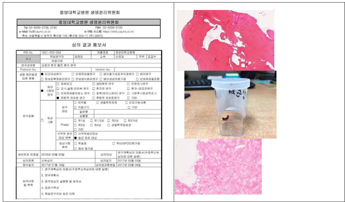 기관윤리위원회 승인 이후 환자 샘플을 수집하고 있으며 (좌), 첫 번째 환자 샘플을 이용하여 pilot 분석을 시행함 (우)