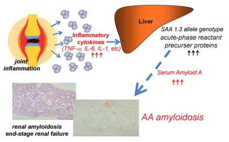 만성 염증질환(류마티스 관절염)에서 SAA 및 amyloidosis (Amyloidosis 2013)
