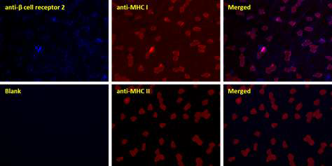 β cell receptor 1 염색 결과