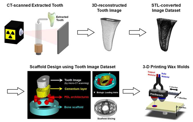 CT를 이용해 치아의 디지털 영상 자료를 만들고, 이를 기반으로 치아 맞춤형 scaffold를 제작함. 특히, 백악질(cementum; 노란색), 치주 인대 (PDL; 붉은색), 그리고 골조직 (bone; 파란색) 들의 구획화한 구조체를 설계하여 3-D 프린팅을 이용해 제작함