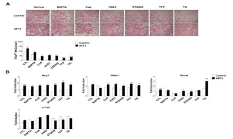 ATF3 is involved in the Ca2+ signaling cascade during osteoclast differentiation