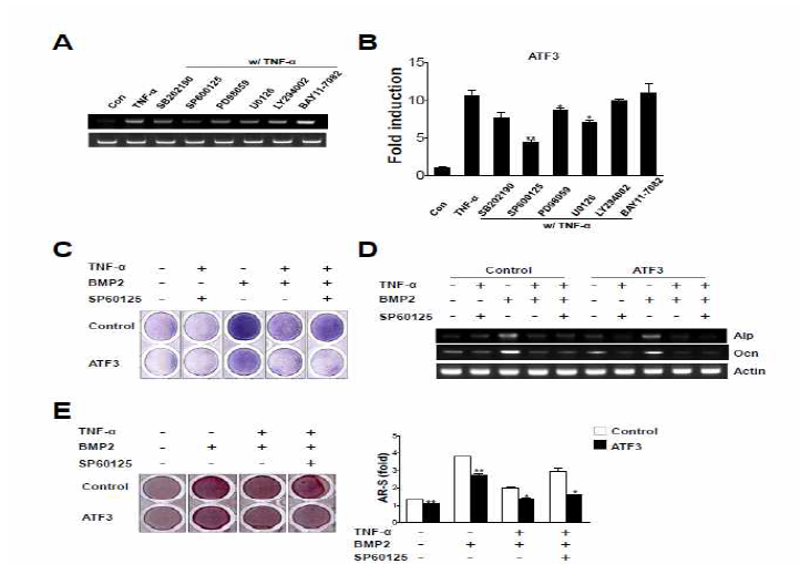 ATF3 modulates the TNF-α-mediated inhibition of osteoblast differentiation via the JNK signaling pathway