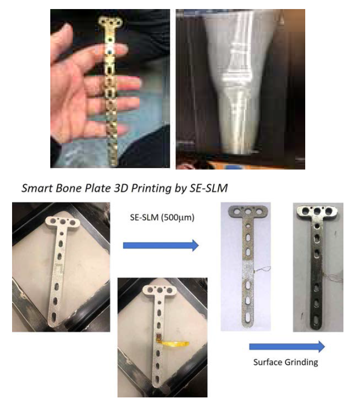 SE-SLM 공정을 활용한 스마트 외상고정부품 3D 프린팅
