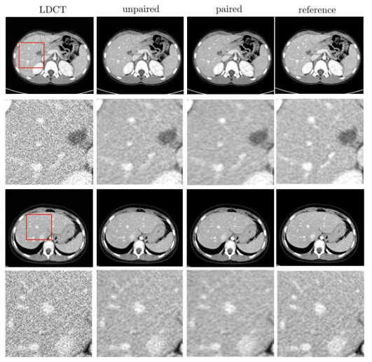 Quantum noise에 대한 본 방식의 결과. 두 번째 세 번째 열은 각각 짝이 있는, 짝이 없는 데이터 셋을 이용한 보정 결과를 나타냄