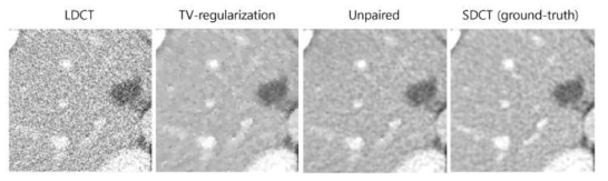 Total variation (TV)기반의 보정 방식과 본 방식의 결과 비교