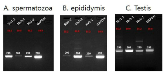 정자 (spermatozoa) 및 고환 (testis)과 부고환 (epididymis) 조직에서 KSper(Slo), Hv1 이온통로의 mRNA 발현 확인 Slo1: 299, Slo3: 304, Hv1: 299, GAPDH: 298