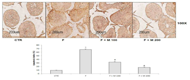 Finasteride 장기 투여후 MOTILIPERM 섭취에 따른 고환에서의 apoptosis 변화