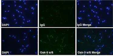 Immunocytochemistry of GSK- α/β in mouse epididymal sperm