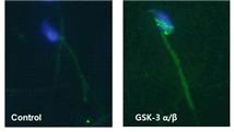 Immunocytochemistry of GSK-α/β in mouse epididymal sperm