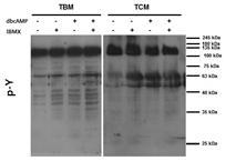Effects of dibutyryl cAMP and IBMX on tyrosine phosphorylation in mouse cauda epididymal sperm
