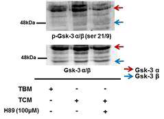 Effects of H89 (PKA inhibitor) on serine inhibitory phosphorylation of GSK3α/β in mouse cauda epididymal sperm