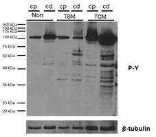 Western blot of tyrosine phosphorylation in mouse caput and caudal epididymal sperm