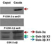 Western blot of serine phosphorylation of GSK3 in mouse epididymal sperm