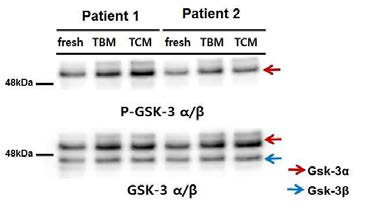 Western blot of GSK3 α/β serine phosphorylation in human sperm