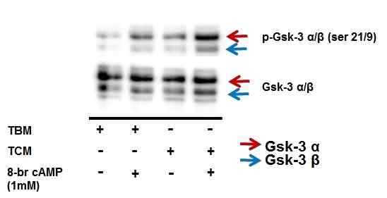 Effects of 8-br cAMP on serine phosphorylation GSK3α/β in human sperm