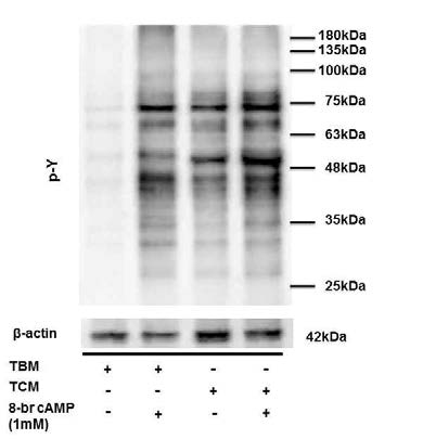 Effects of 8-Br cAMP on tyrosine phosphorylation GSK3α/β in human sperm
