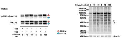 Changes of the phosphorylation of GSK-3 and tyrosine phosphorylation in PKA activation using Calyculin A (PP1 gamma 2 inhibitor) in human sperm