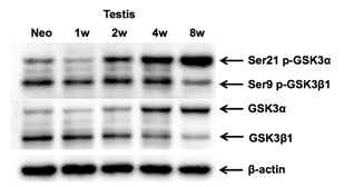 Expression of　GSK3 α/β in developing mouse testis