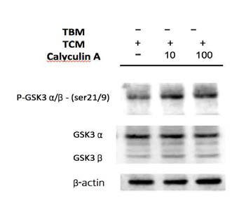 Changes of the phosphorylation of GSK-3 and tyrosine phosphorylation in PKA activation using Calyculin A in mouse sperm