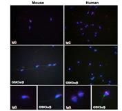 Immunocytochemistry of GSK-3 shows the localization in hunan and mouse sperm