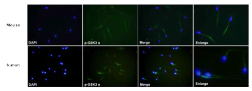 Immunocytochemistry of phospho GSK-3α, ser21) shows the localization in mouse and human sperm