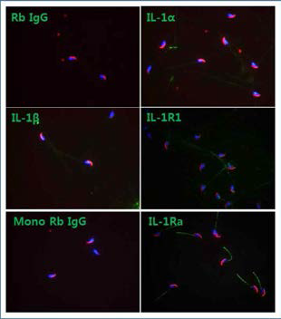 Expression of interleukin-1 system in mouse sperm