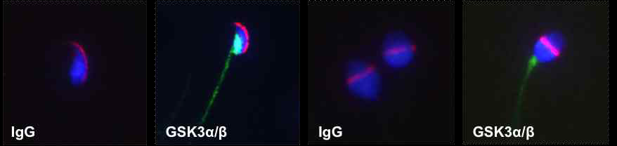 Representative image of GSK3α/β in mouse and human sperm
