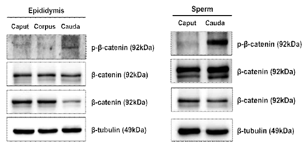 Expression of β-catenin and p-β-catenin in mouse epididymis and sperm extracts