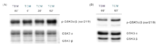 Expression of GSK-3α/β and p-GSK-3α/β(ser21/9) in mouse and human sperm with differential media