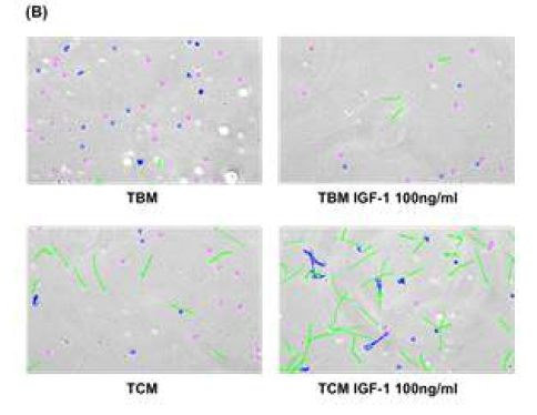 (B). Sperm motility parameters measured by CASA system. Sperm motility was indicated in colors; Green (progressive), Blue (non-progressive), Purple (immotile)