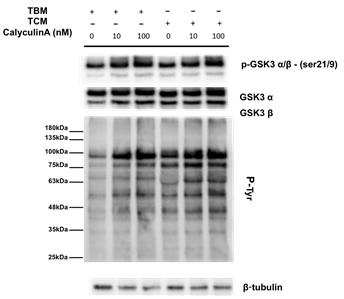 Calyculin A induced progressive motility and inhibitory serine phosphorylation of GSK3α/β in human sperm