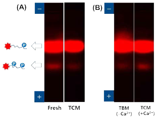Gel-shift assay를 이용한 사람정자 extract에서의 GSK3활성분석결과: (A) Fresh extract와 TCM 배양액에서의 활성비교 (B) TBM과 TCM 배양액에서의 활성비교