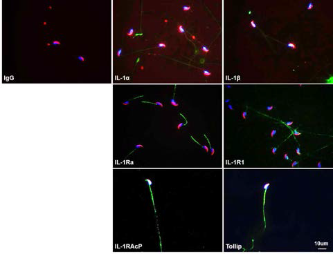 Localization of IL-1 system in mouse spermatozoa